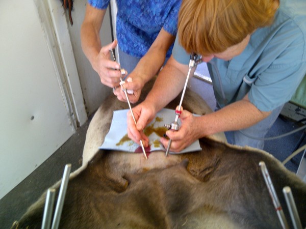 These small holes are used to insert a laproscope so the uterus can be found. q